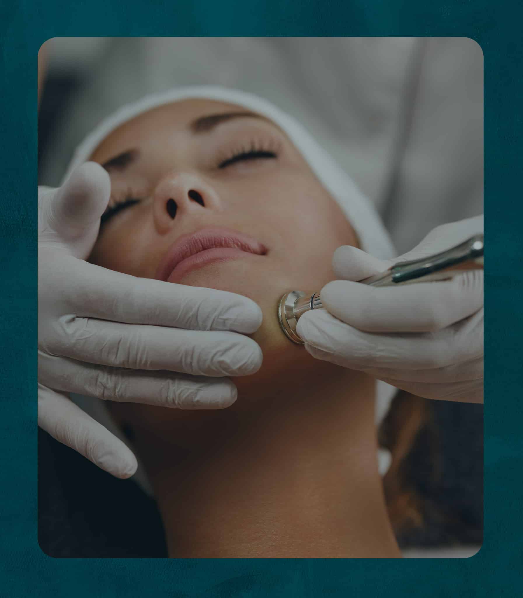 Microdermabrasion